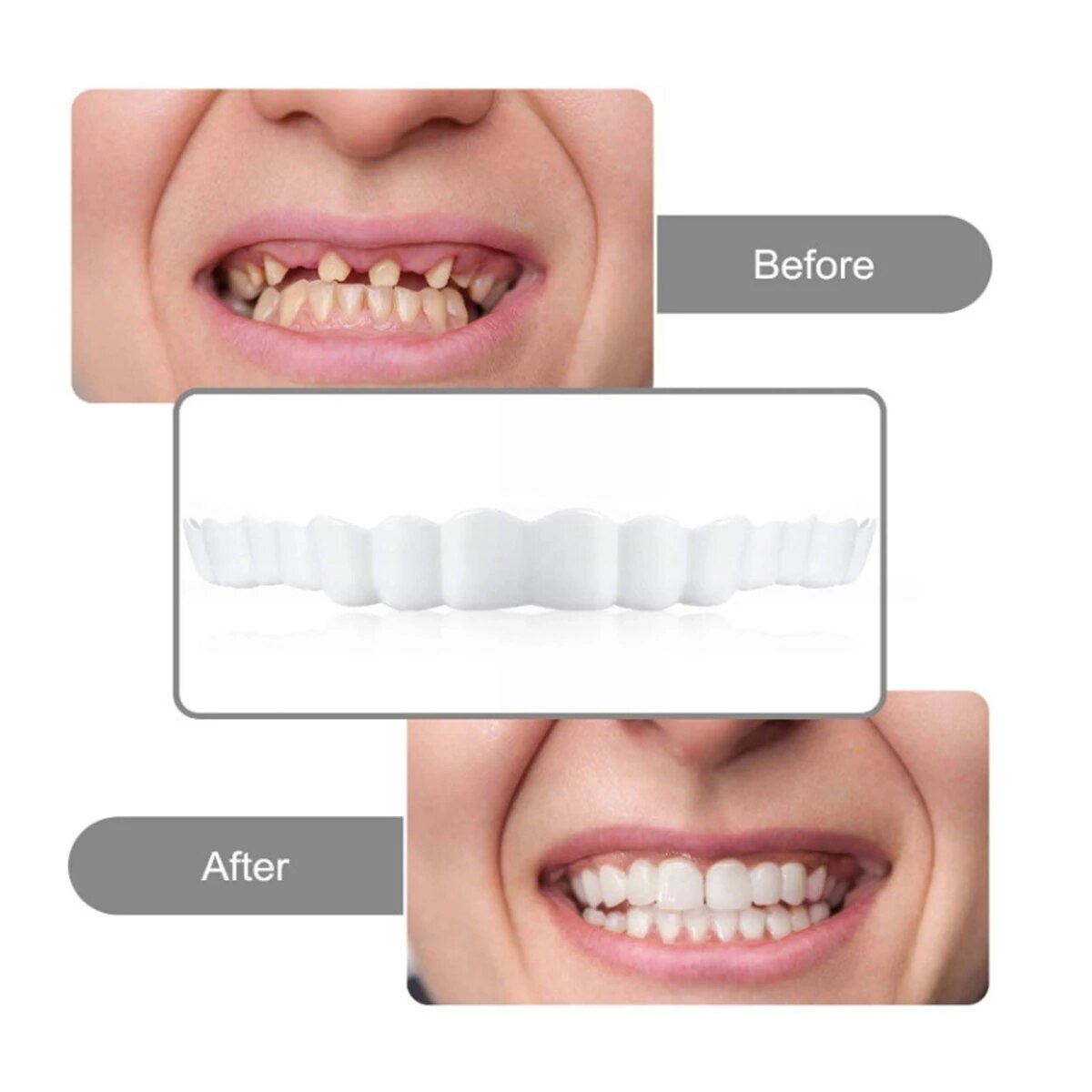 Dentaduras postizas cosméticas Dientes postizos temporales Cubierta dental  superior e inferior